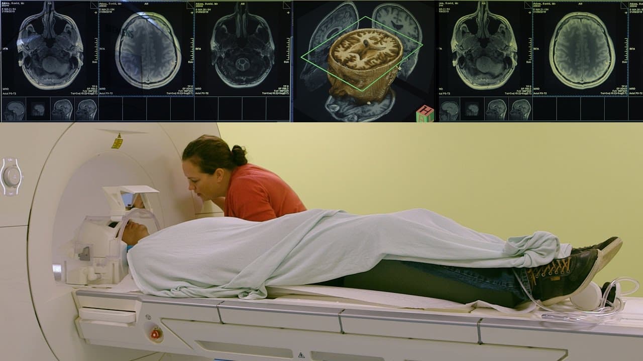 Understanding the OCD Brain: Inside a Patient's Head